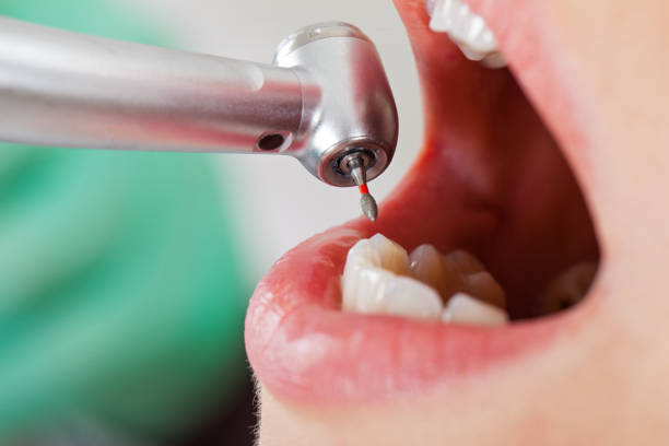 Best Urgent Tooth Repair  in Edina, MO